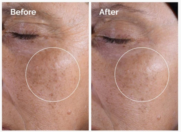 Mini Glycolic Acid 7% Exfoliating Toner