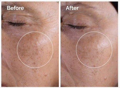 Mini Glycolic Acid 7% Exfoliating Toner